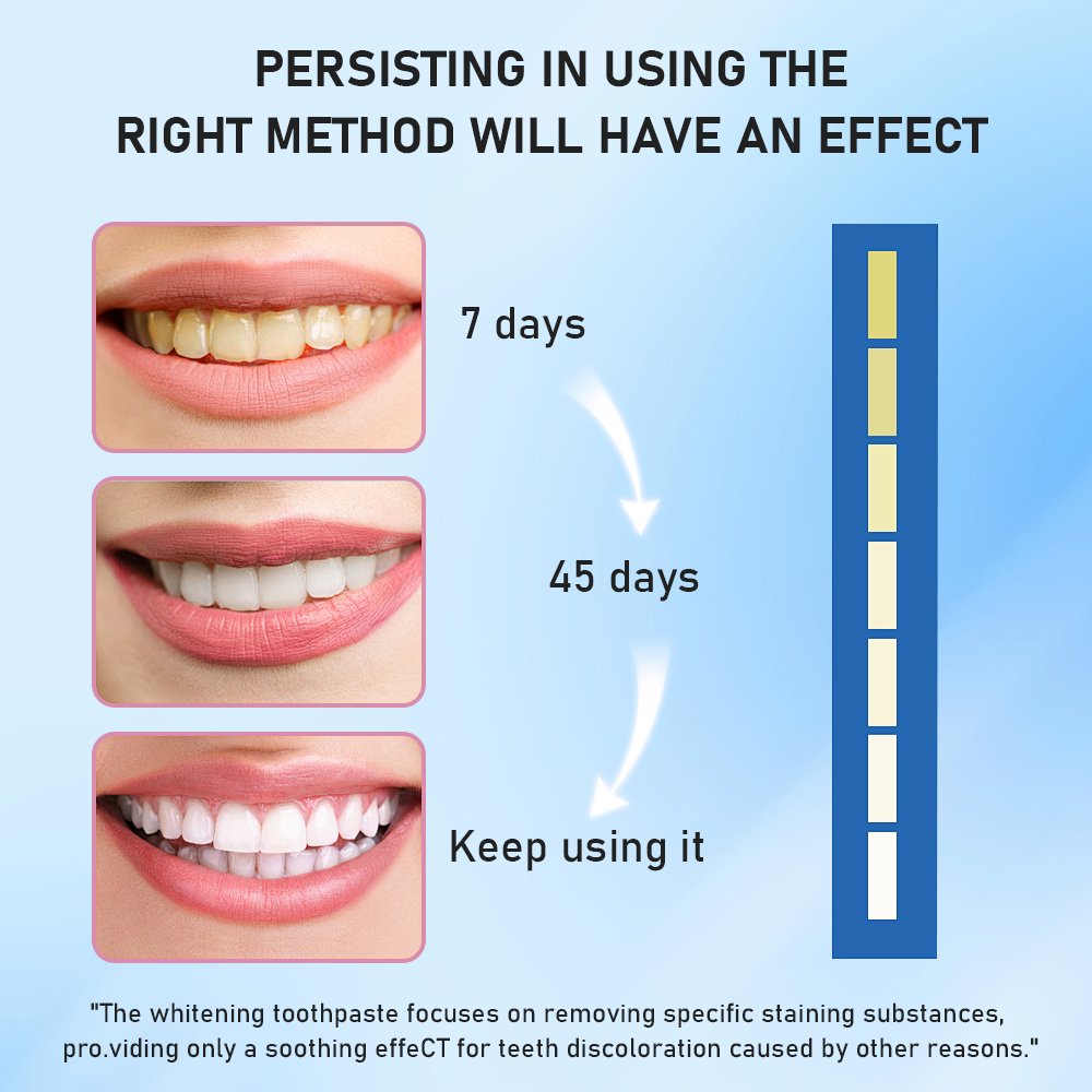 Hotluck Niacinamide Toothpaste